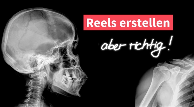 Reels erstellen