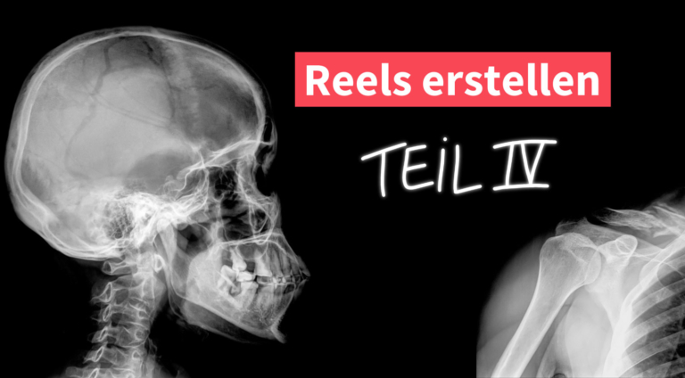 Reels erstellen